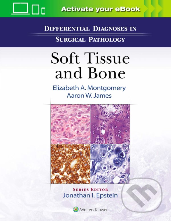 Kniha: Differential Diagnoses in Surgical Pathology: Soft Tissue and Bone (Elizabeth A. Montgomery a Aaron James)