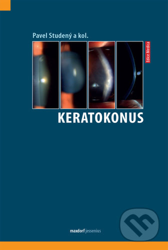 Levně Keratokonus - Pavel Studený - kniha z kategorie Oftalmológia a otolaryngologia