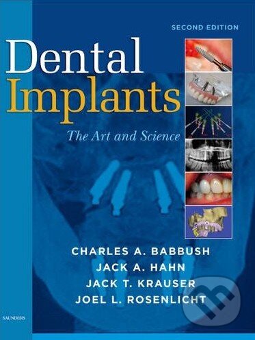 Kniha: Dental Implants (Charles A. Babbush et al.). Saunders, 2010