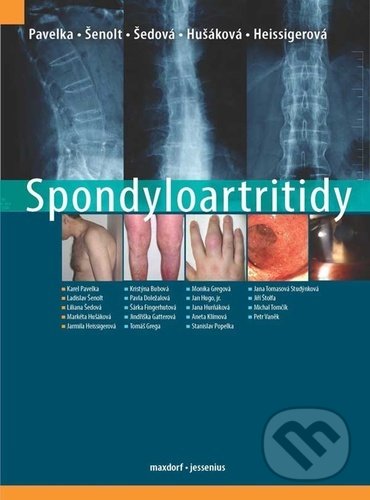 Spondyloartritidy - Karel Pavelka, Ladislav Šenolt, Liliana Šedová, Maxdorf, 2021