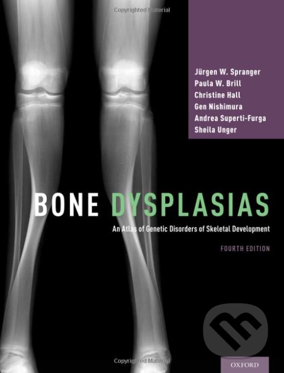 Levně Bone Dysplasias (An Atlas of Genetic Disorders of Skeletal Development) - kniha z kategorie Medicína