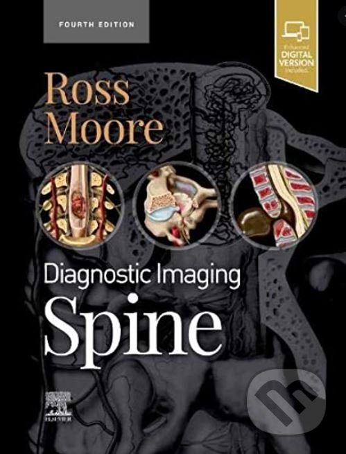 Levně Diagnostic Imaging: Spine - Kevin R. Moore, Jeffrey S. Ross - kniha z kategorie Vysoké školy