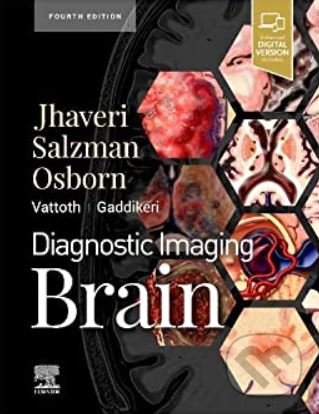 Levně Diagnostic Imaging: Brain - Miral D. Jhaveri - kniha z kategorie Medicína