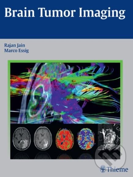 Levně Brain Tumor Imaging - Rajan Jain, Marco Essig - kniha z kategorie Medicína