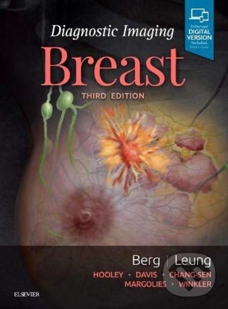 Levně Diagnostic Imaging: Breast - Wendie A. Berg, Jessica Leung - kniha z kategorie Medicína