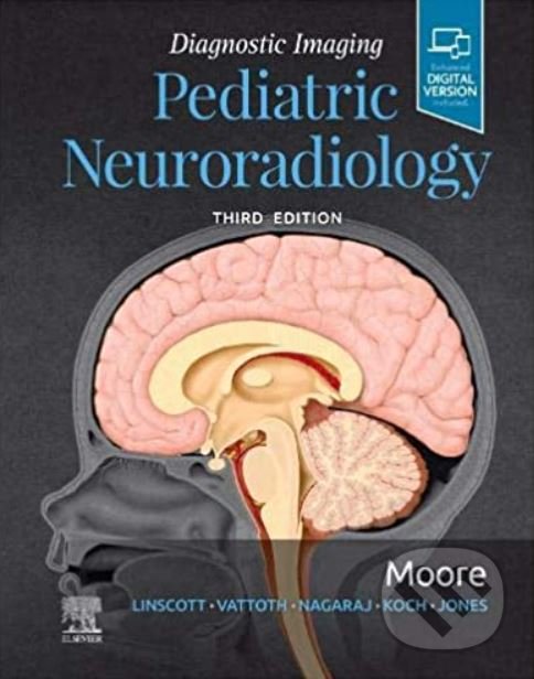 Levně Diagnostic Imaging: Pediatric Neuroradiology - Kevin R. Moore - kniha z kategorie Medicína