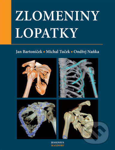 Levně Zlomeniny lopatky - Jan Bartoníček, Michal Tuček, Ondřej Naňka - kniha z kategorie Úrazová chirurgia a ortopédia